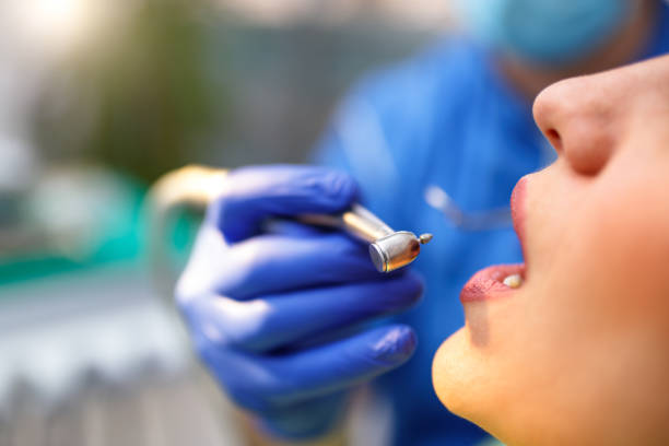 Dental Inlays and Onlays in Athens, OH